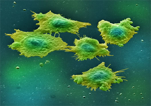 cellule tumorali 