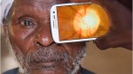 Salute App fotografa in dettaglio struttura interna occhi